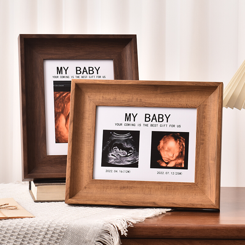 宝宝四维彩超NTB超照片打印孕期婴儿出生礼物定制相框纪念照摆台