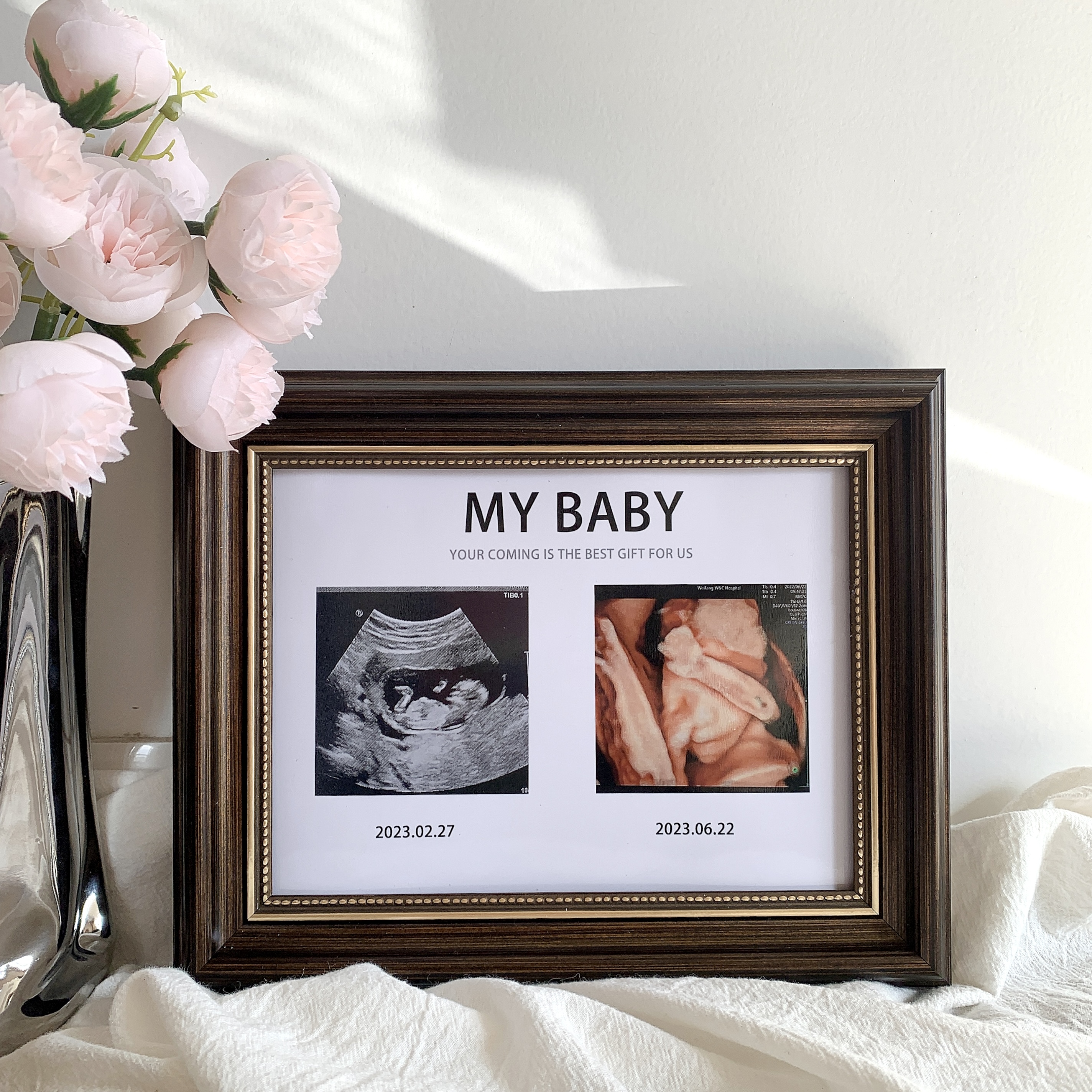 宝宝四维照片相框孕期NT B超图打印婴儿出生礼物摆台纪念照