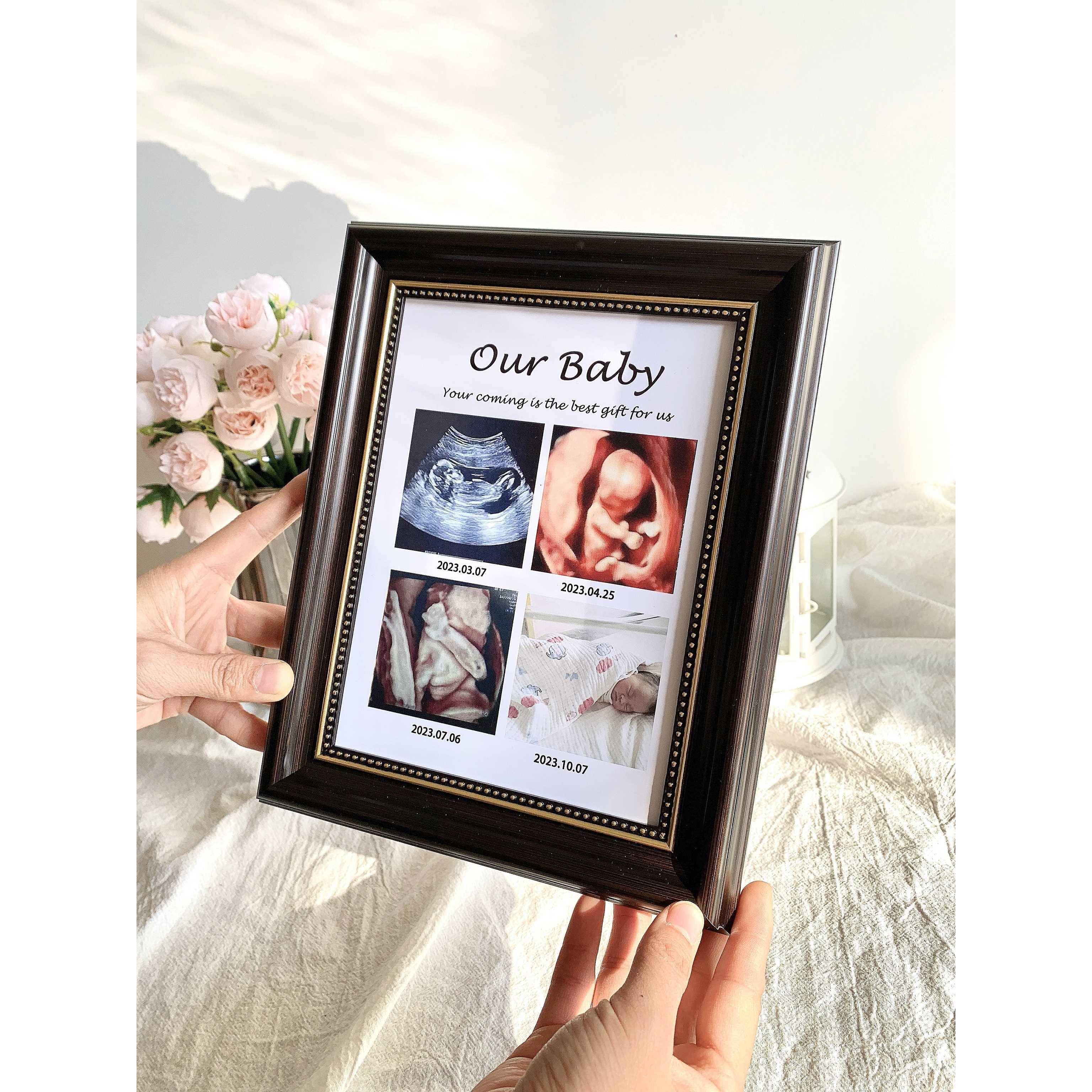 宝宝b超四维照片打印婴儿出生礼物摆台相框nt四宫格孕期记录留念