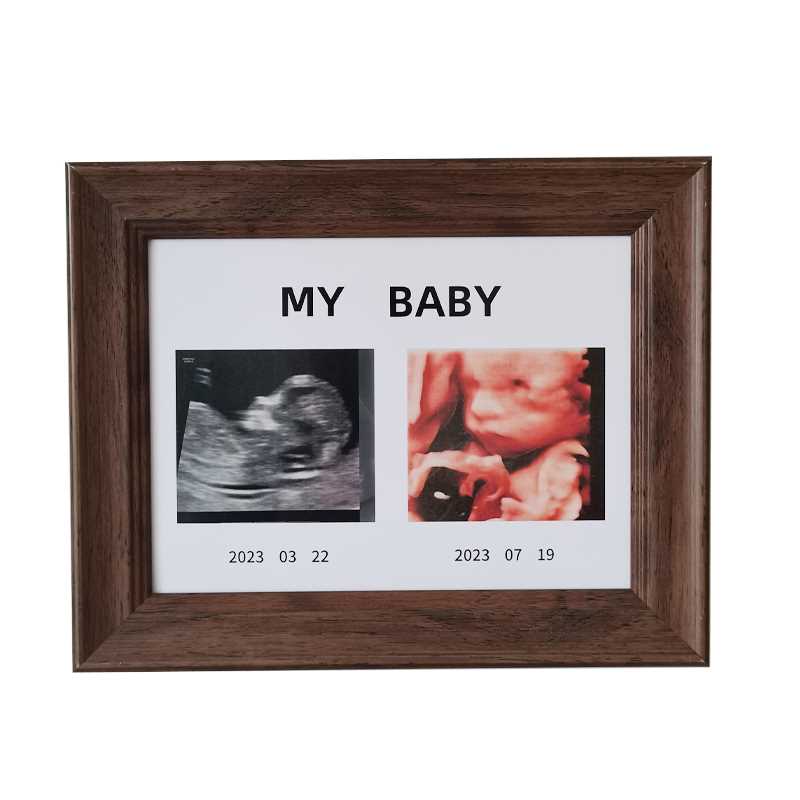 四维照片宝宝B超相框彩超NT打印怀孕婴儿出生礼物定制纪念摆台挂